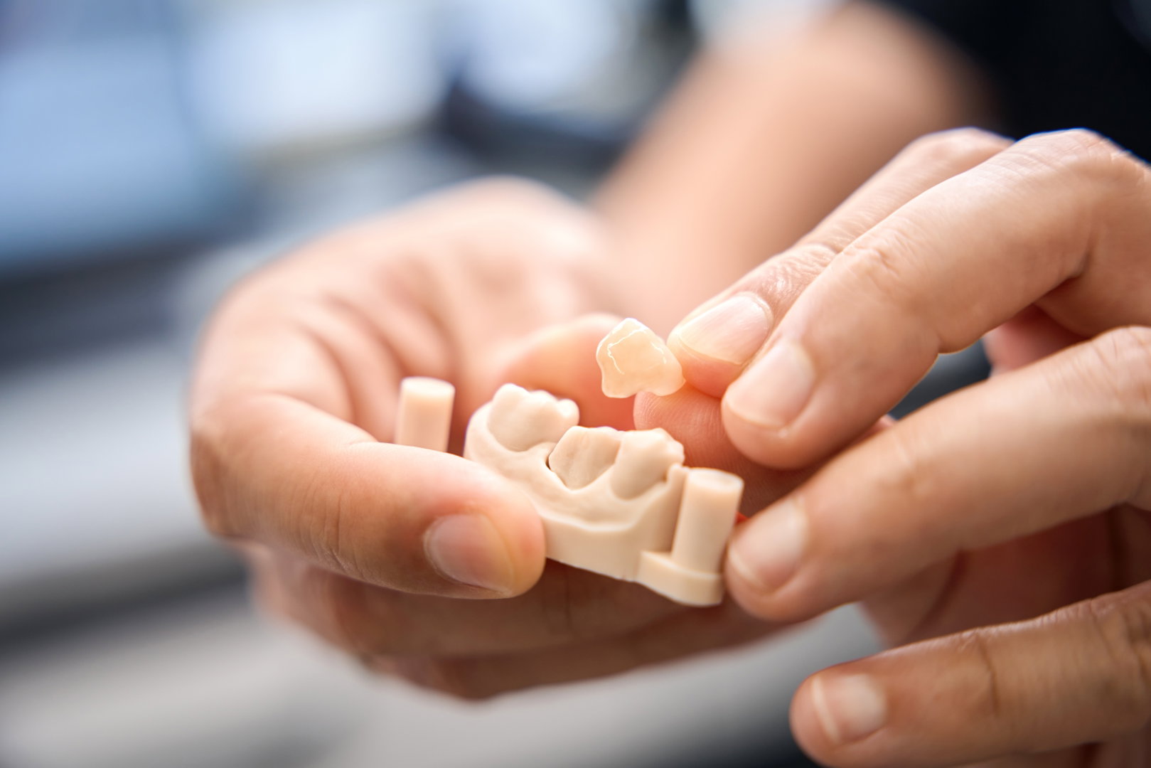 Why Are Dental Crowns Important, and Which Dentist Can Treat Me