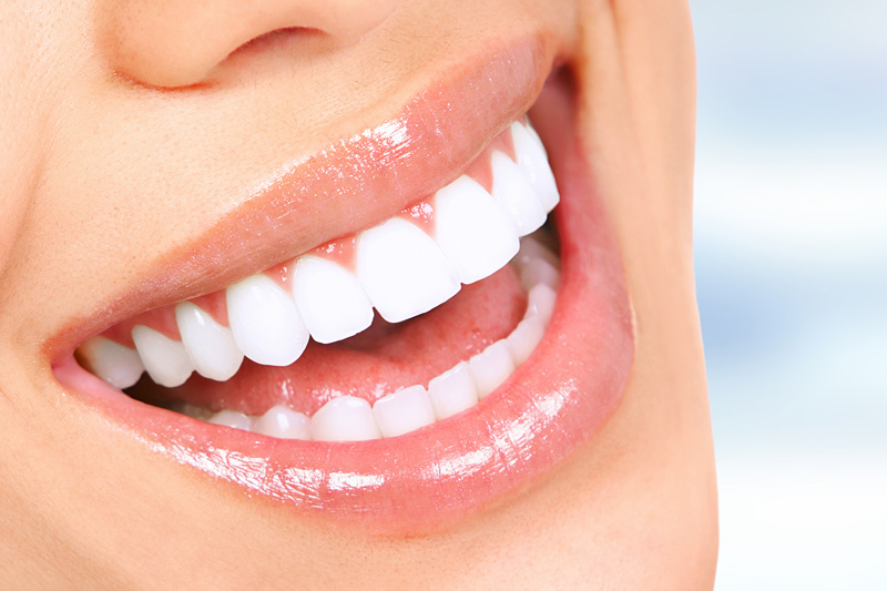 Cosmetic Dentistry in South Gate